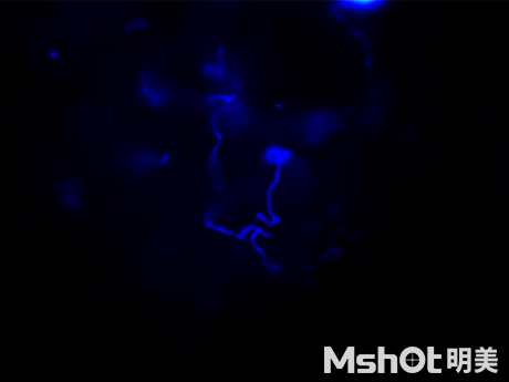 熒光生物顯微鏡應用于醫(yī)院皮膚真菌檢查